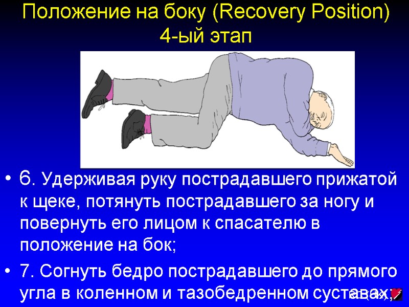Положение на боку (Recovery Position) 4-ый этап  6. Удерживая руку пострадавшего прижатой к